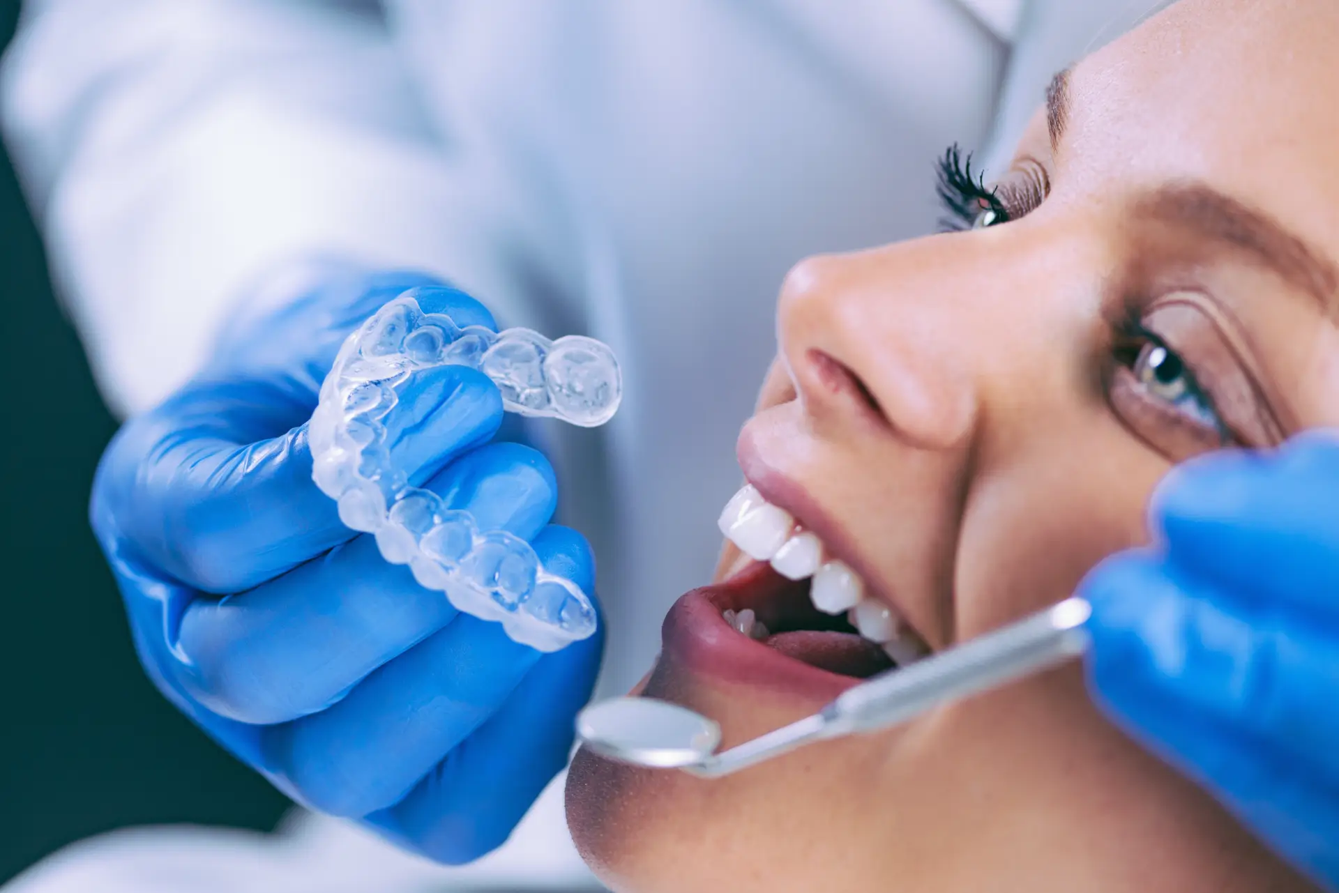 invisalign istock 1172503526 (1)