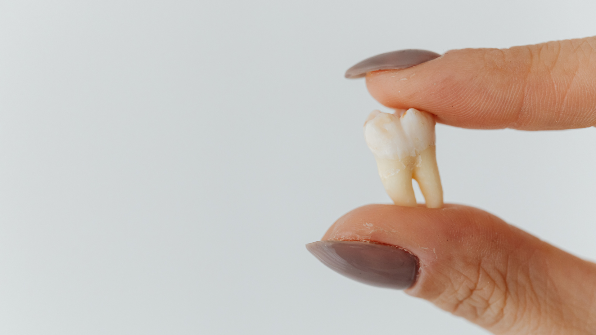 https://www.starlitedental.com/wp-content/uploads/2025/04/extractions-2.webp