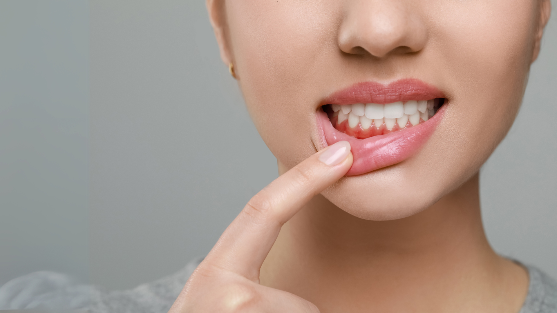 https://www.starlitedental.com/wp-content/uploads/2025/04/gum-contouring.webp