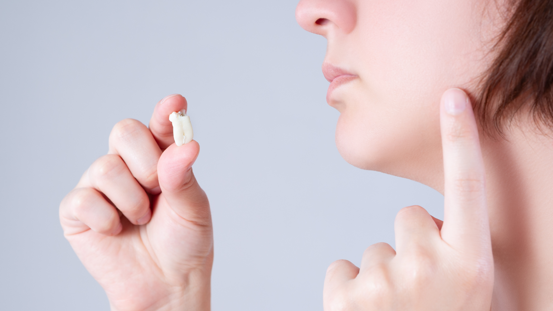 https://www.starlitedental.com/wp-content/uploads/2025/04/wisdom-teeth.webp
